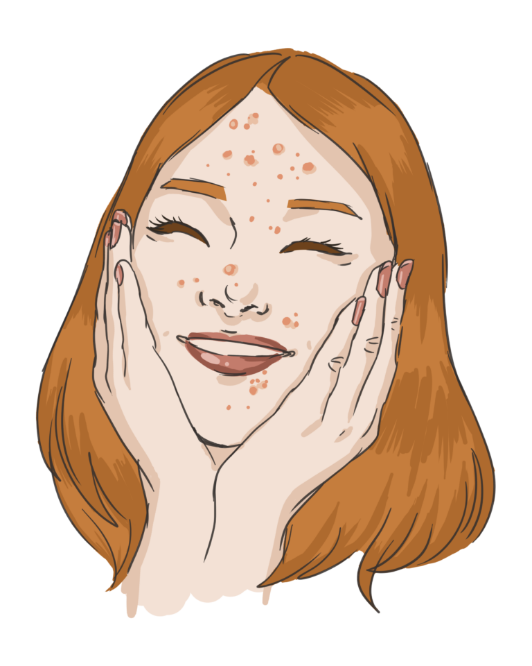 Your Pimples are Cute