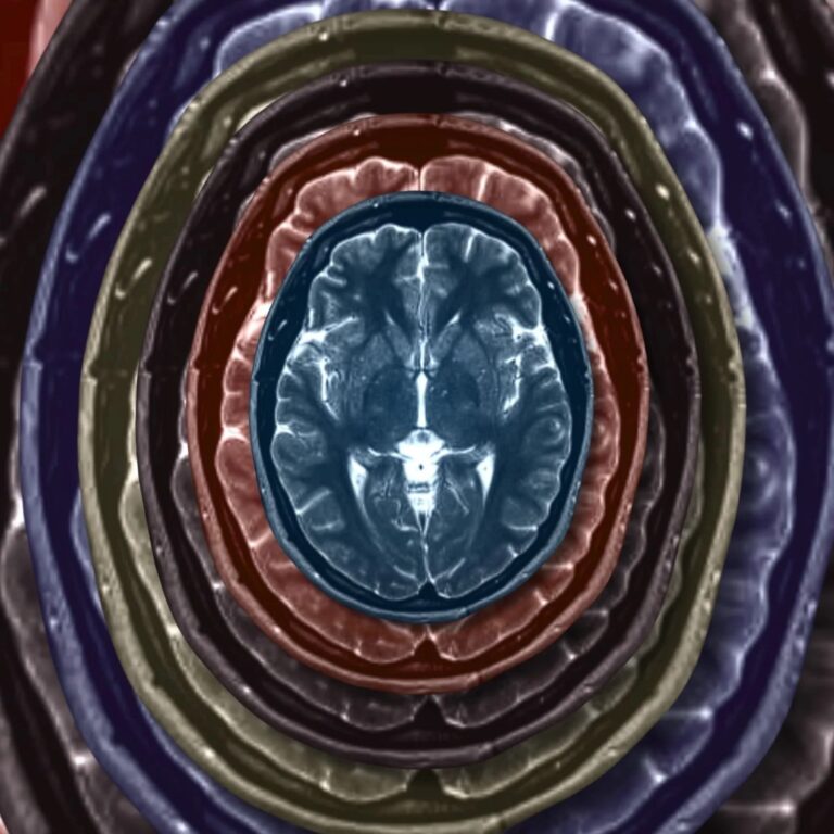 Transcendence